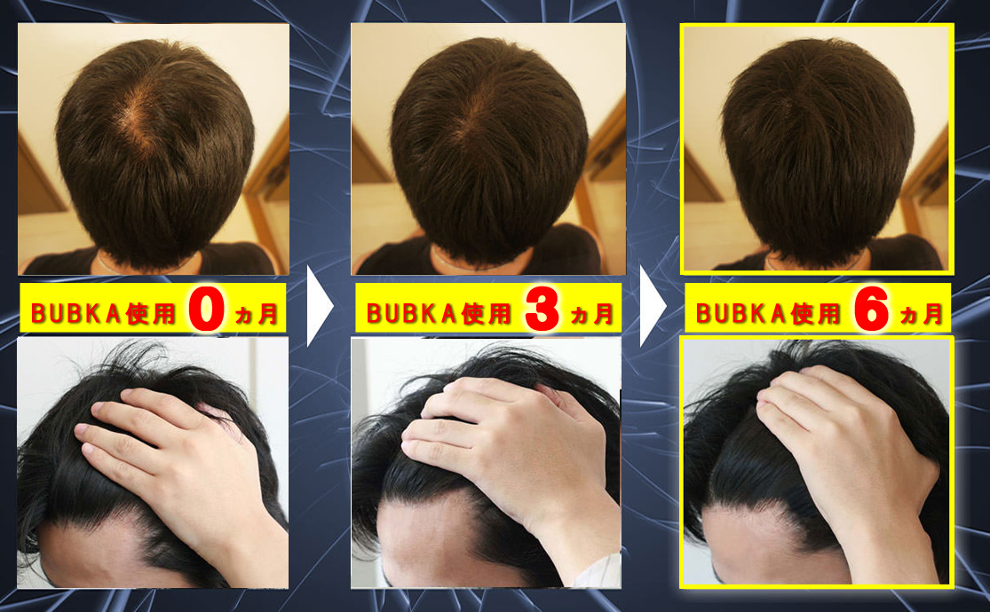 �u�u�J�̎g�p�O��摜