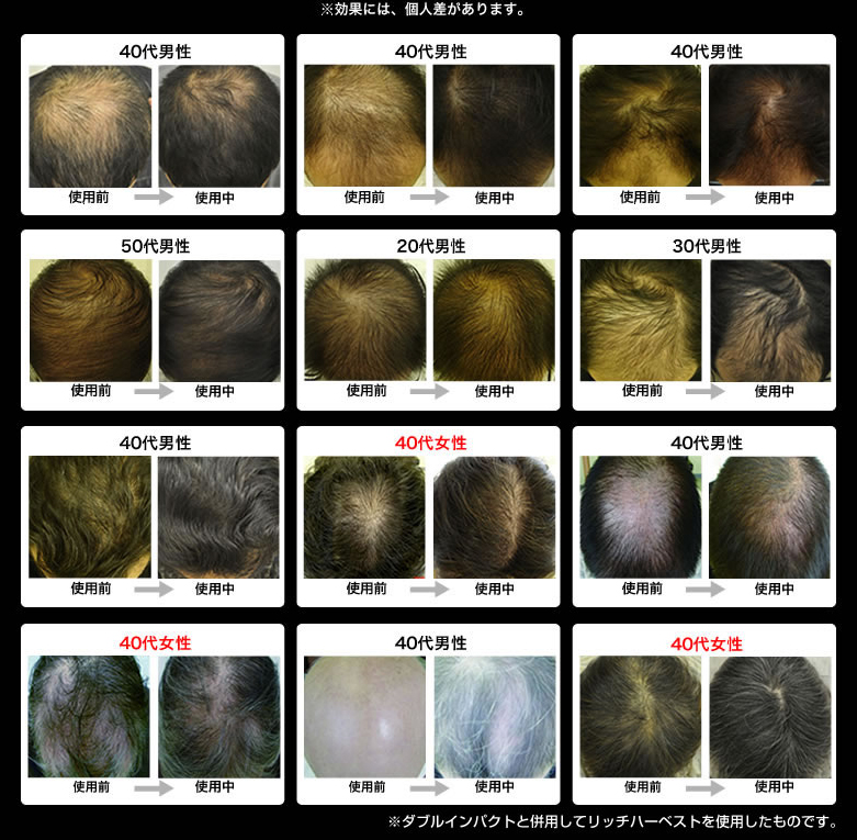 �_�u���C���p�N�g�̎g�p�O��摜